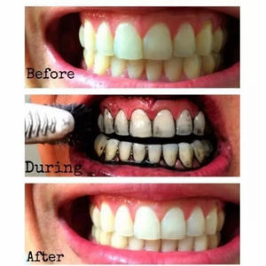 Blanqueador Dental Carbon Coco™