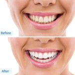 Kit Blanqueador dental luz led Dientes Blancos