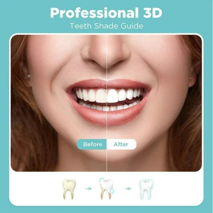 Kit Blanqueador dental luz led Dientes Blancos